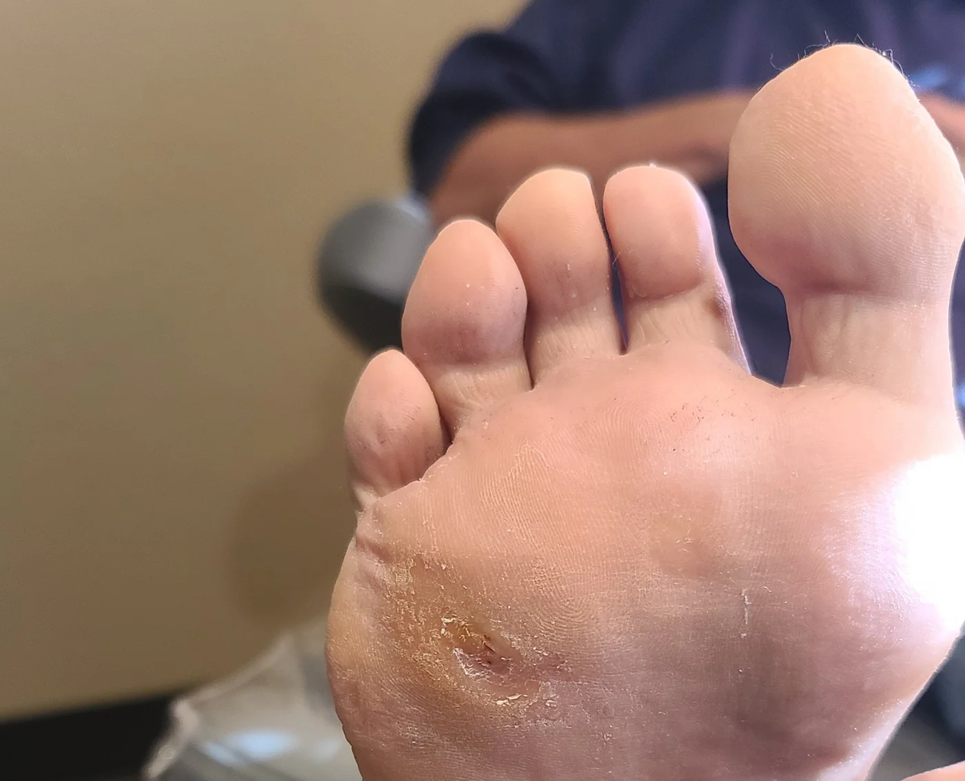 Healed wound after treatment